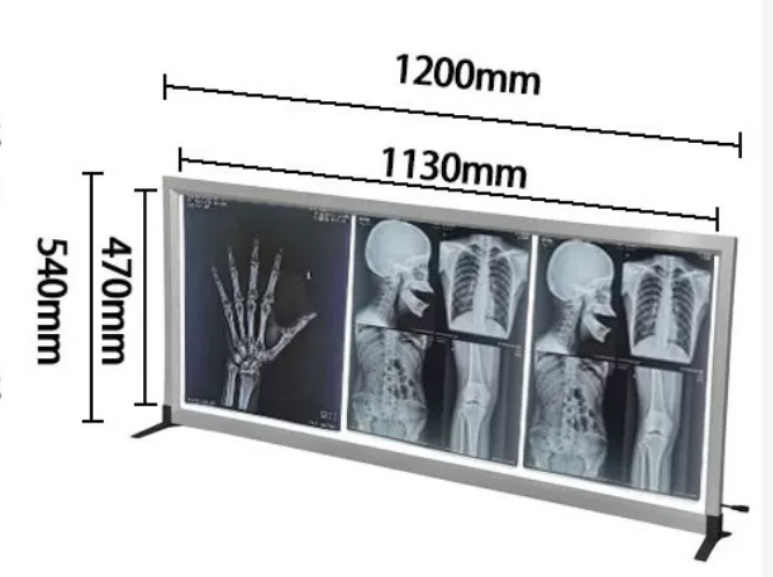 Medical Film Viewer, LED, 3 pages, 120*54*1.7cm，0-3500cd/m&sup2;-0