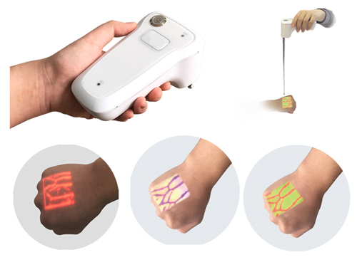 Vein Imaging Device-0