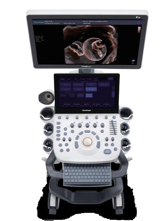 Trolley Color Doppler Ultrasound machine  -0