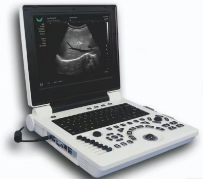 Esc&aacute;ner ultras&oacute;nico port&aacute;til con funci&oacute;n opcional 3D-0