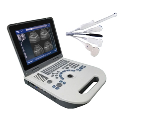 Full Digital LED Portable Ultrasound-0