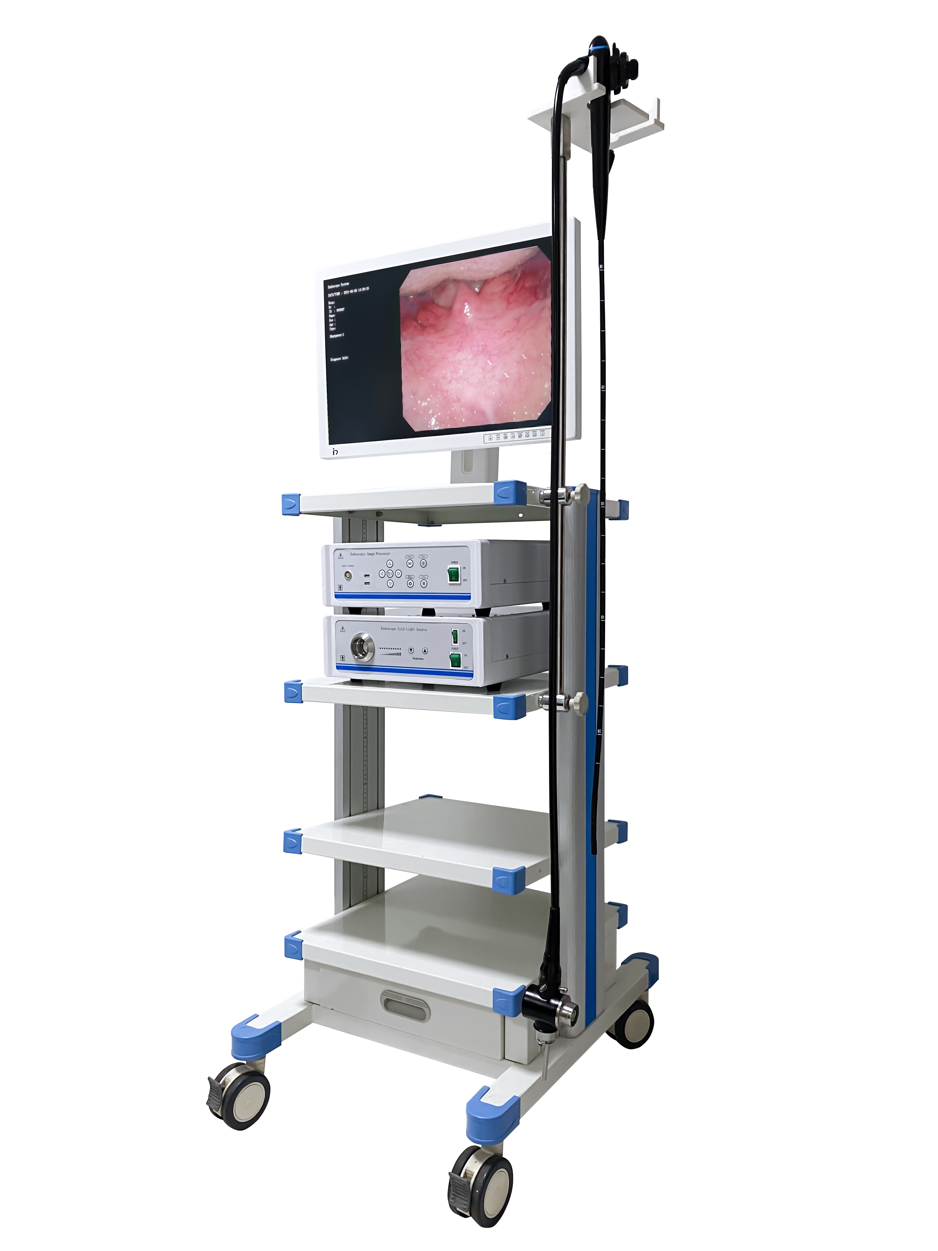 Video Gastroscope System(Video Gastroscope+Medical Monitor+Light Source+Video Image Processor+Trolley)-0