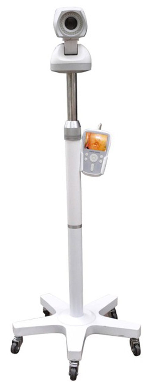 Portable Digital Trolley Colposcope-0
