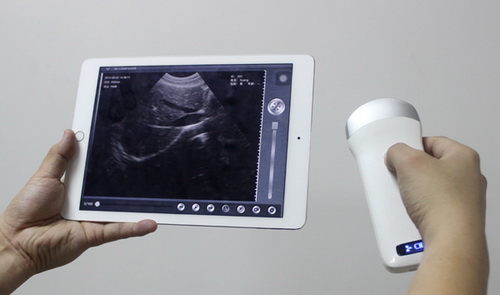 Wireless Ultrasound Convex Linear Microconvex Transvaginal Probe-0