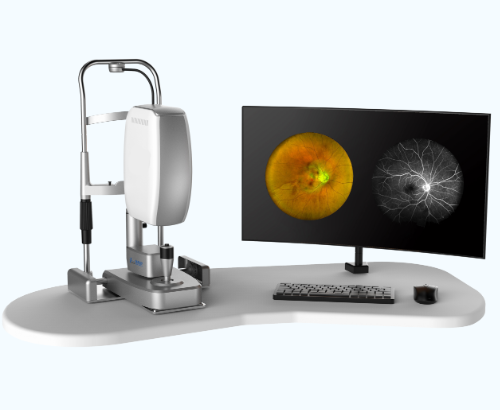 Ultra-wide-angle laser fundus angiography with Fundus Autofluorescence FAF and Fundus Fluorescein Angiography 