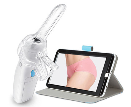 Portable Digital electronic colposcope-0