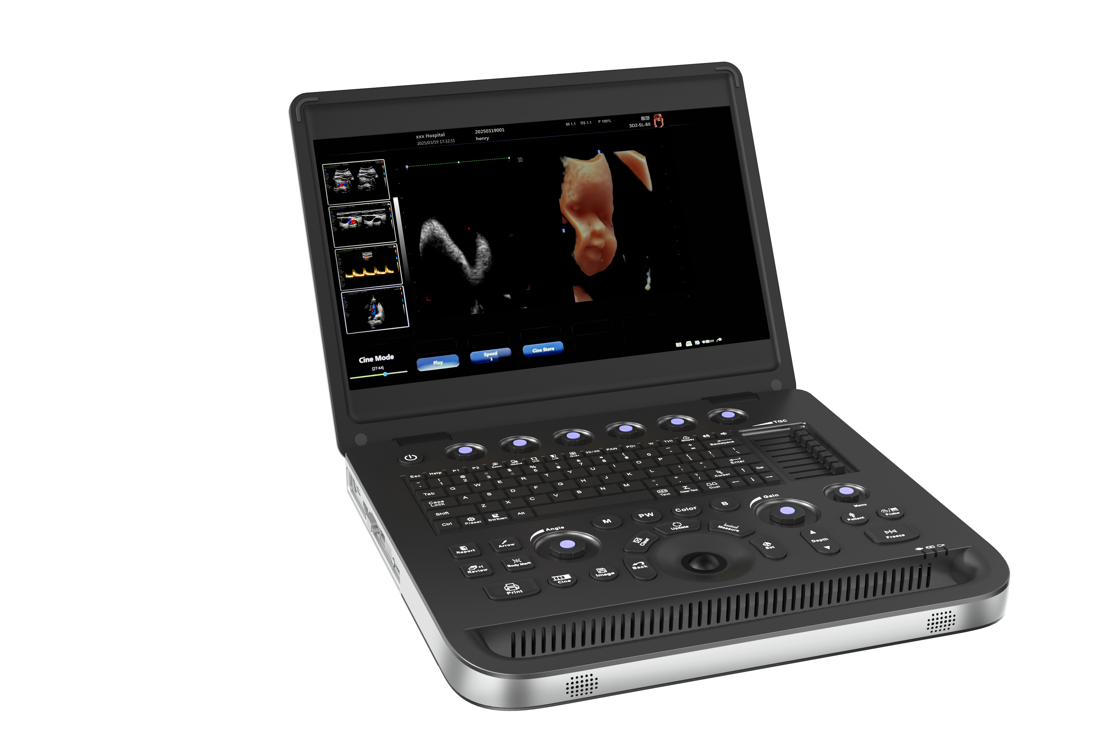 15.6-inch color ultrasound machine-0