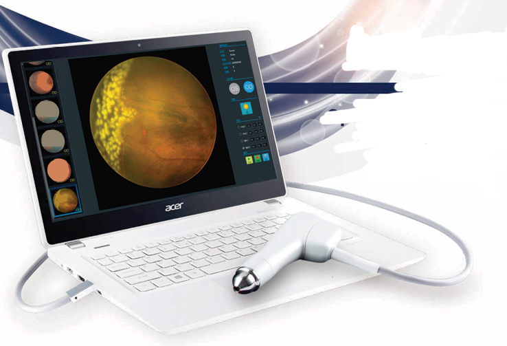 Ophthalmic Wide Field （OPTOS）-0