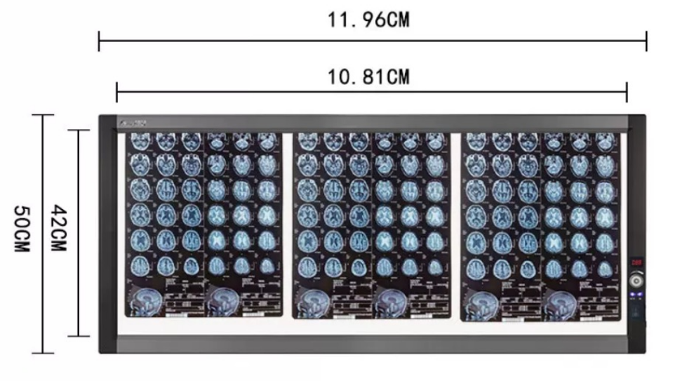 Medical Film Viewer, LED, 3 pages, 120*50*2.5cm, 0-4500cd/m&sup2;-0