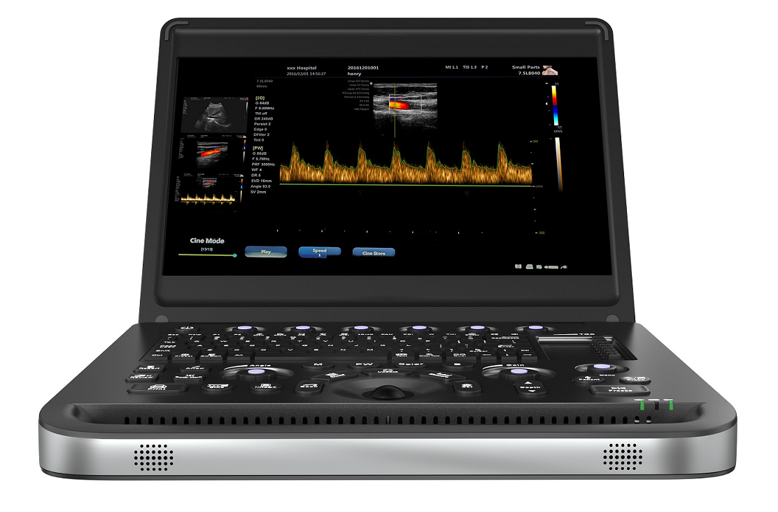 Economica 15.6" Notebook Color Doppler 3D with battery,Optional 4D and support CW function-0