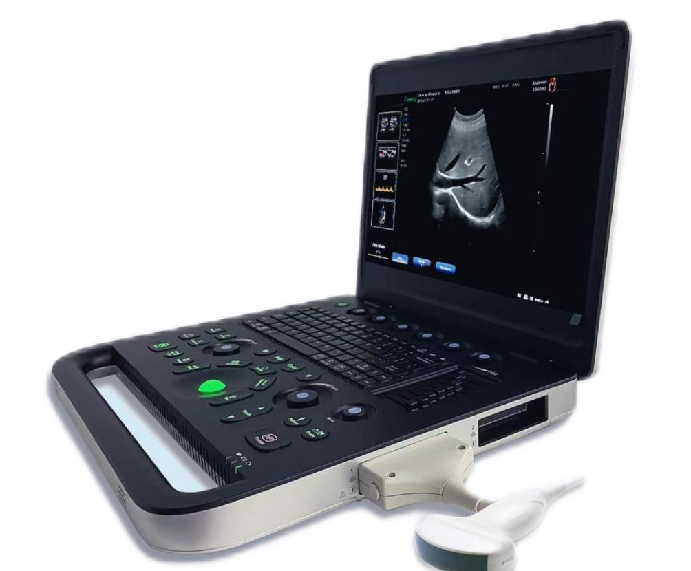 Economica 15.6" Notebook Color Doppler 3D with battery,Optional 4D and support CW function-1