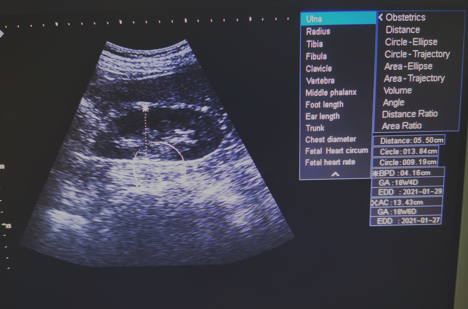 12-inch ARM Platform Laptop Black and White Ultrasound-2