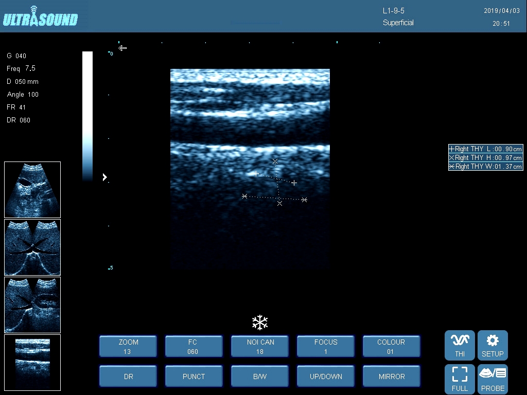 12-inch ARM Platform Laptop Black and White Ultrasound-3