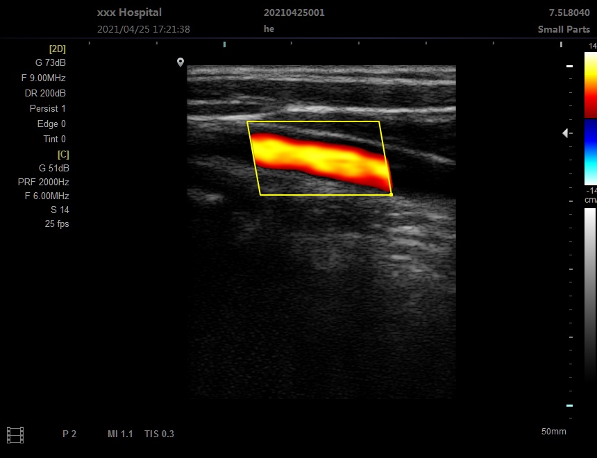 Notebook Color Doppler Ultrasound Scanner-E20-0