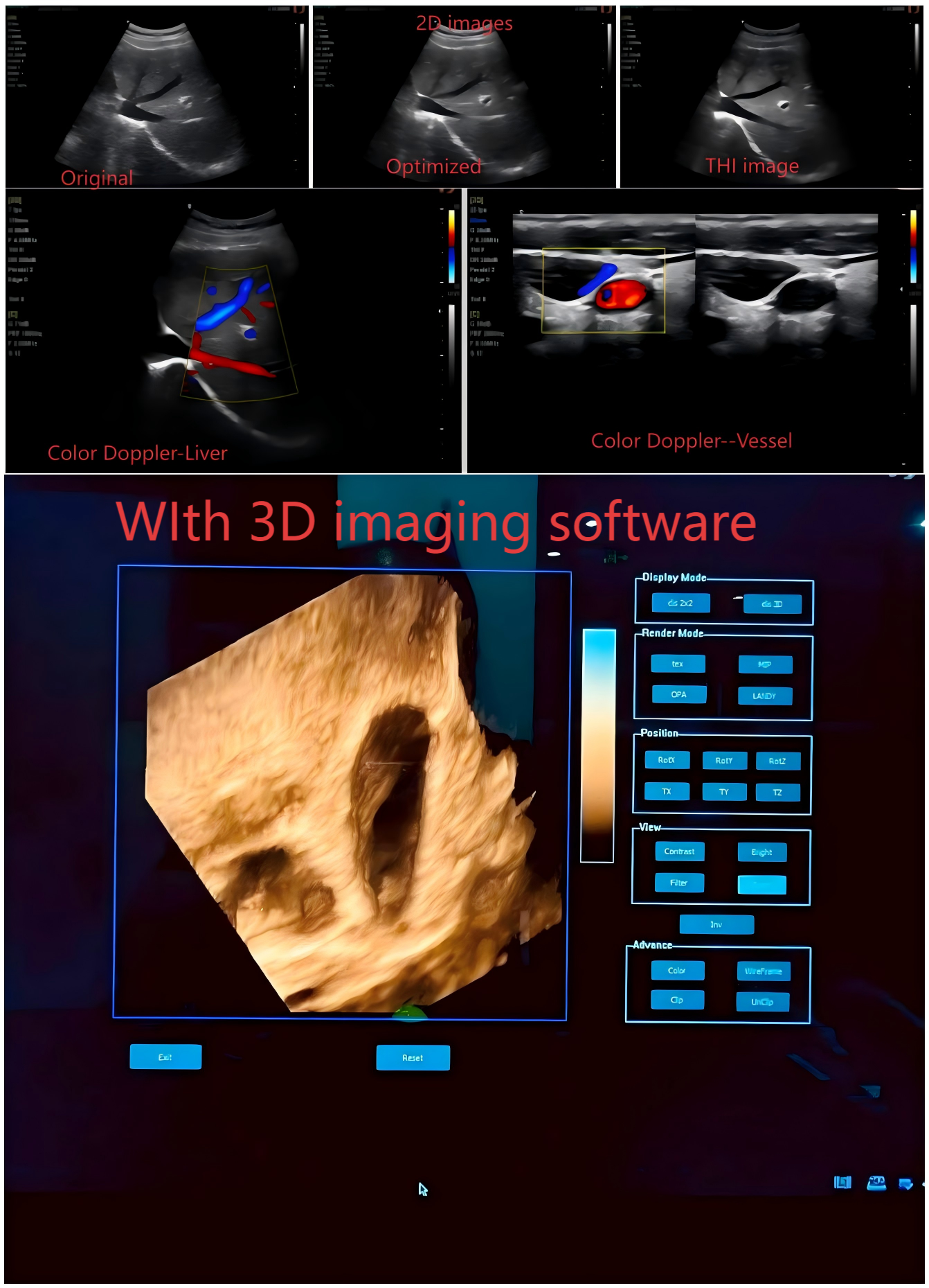Economica 15.6" Notebook Color Doppler 3D with battery,Optional 4D and support CW function-4