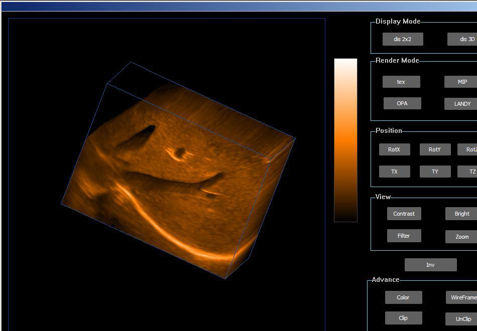 Notebook Color Doppler Ultrasound Scanner-E20-1