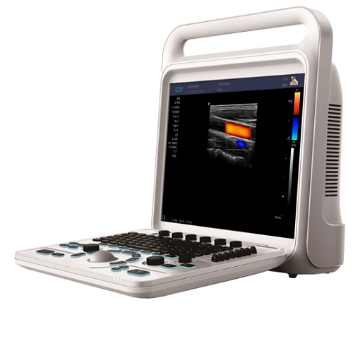15 inch Screen Portable Color Doppler
 With 3D Optional-1