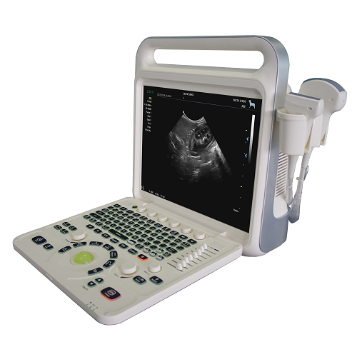 15 inch Screen Portable Color Doppler
 With 3D Optional-2