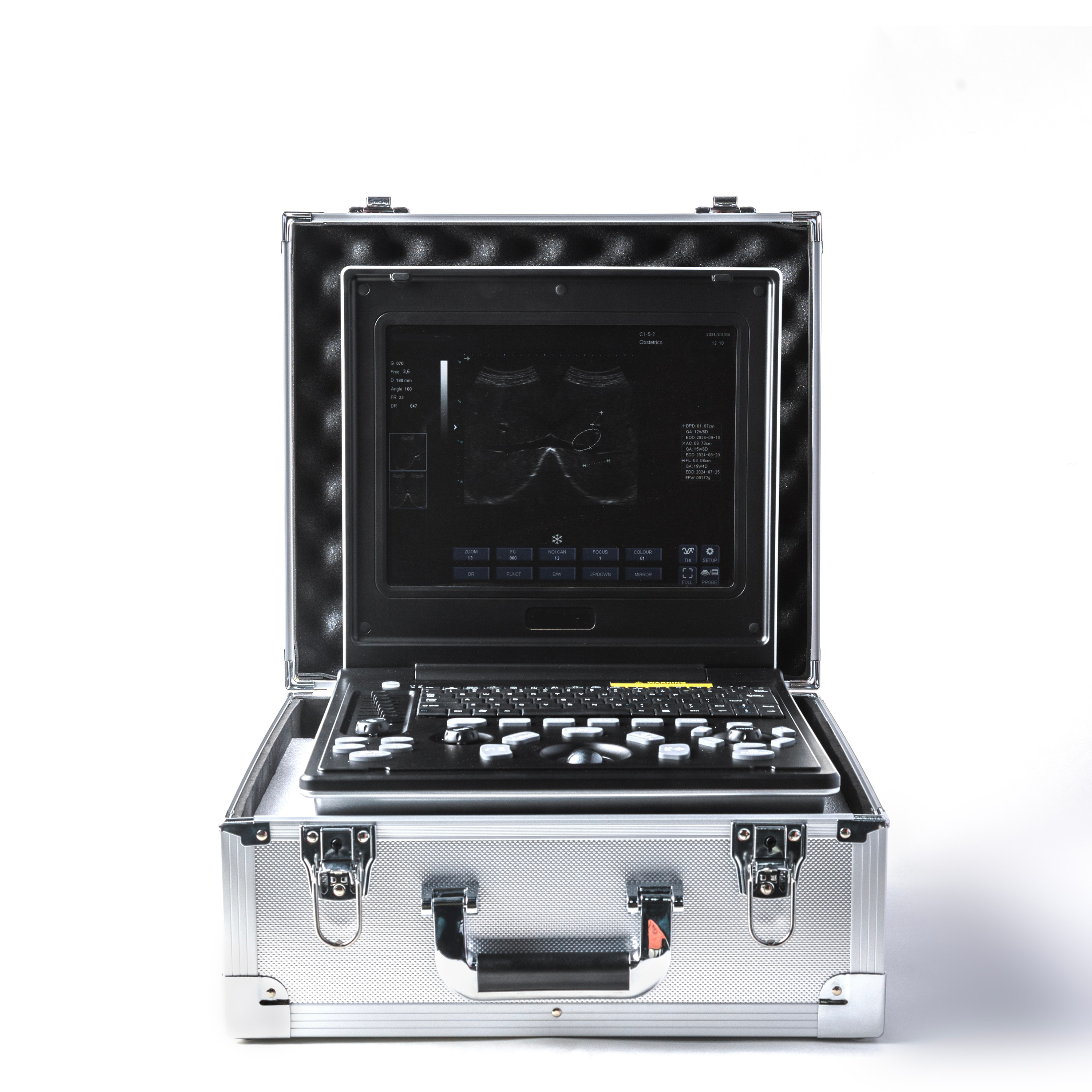 Notebook Full Digital Ultrasonic Diagnostic Scanner -0