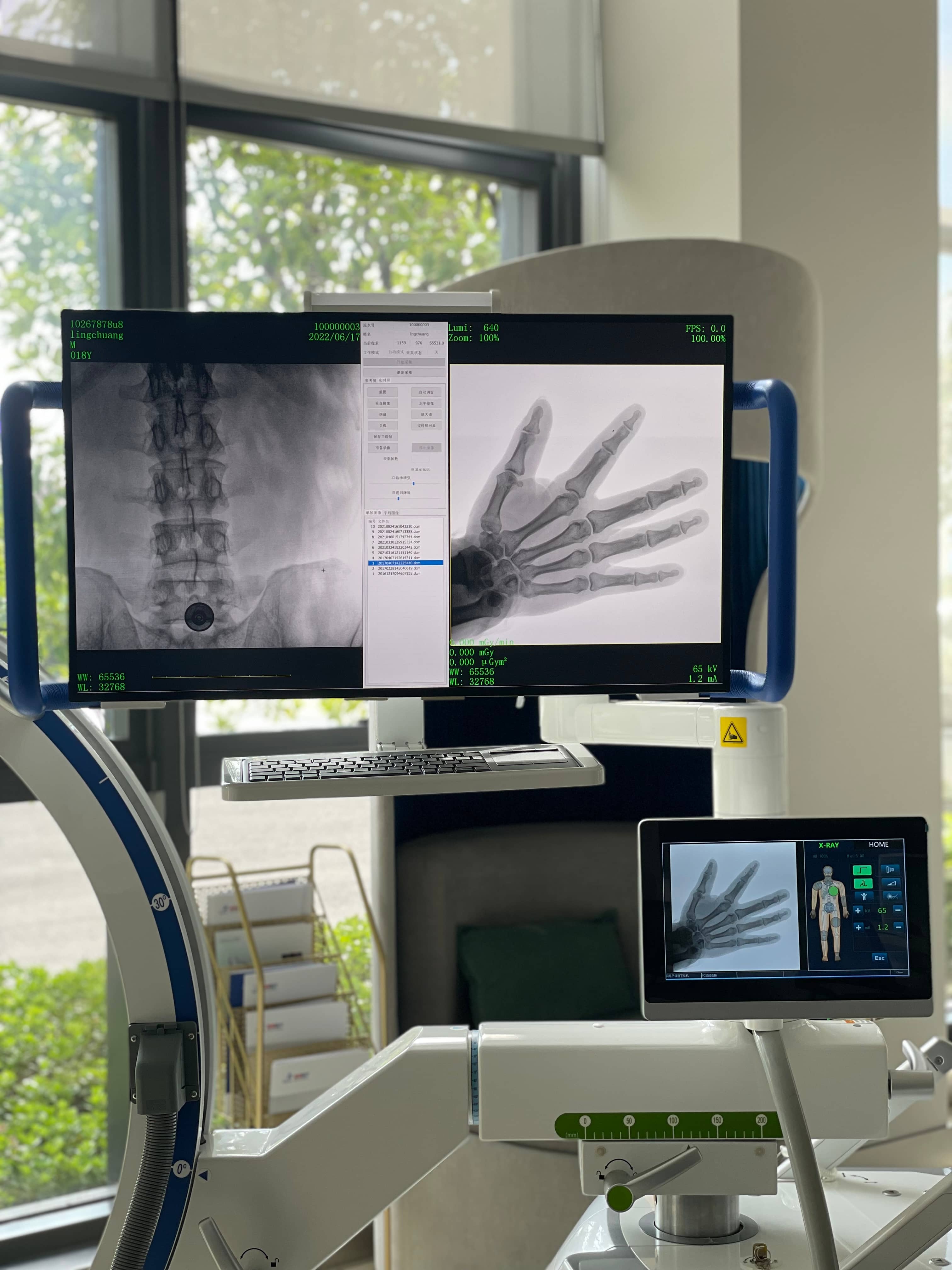 5KW 100mA Digital integrated Dynamic Flat Panel C-arm X-ray Machine -2