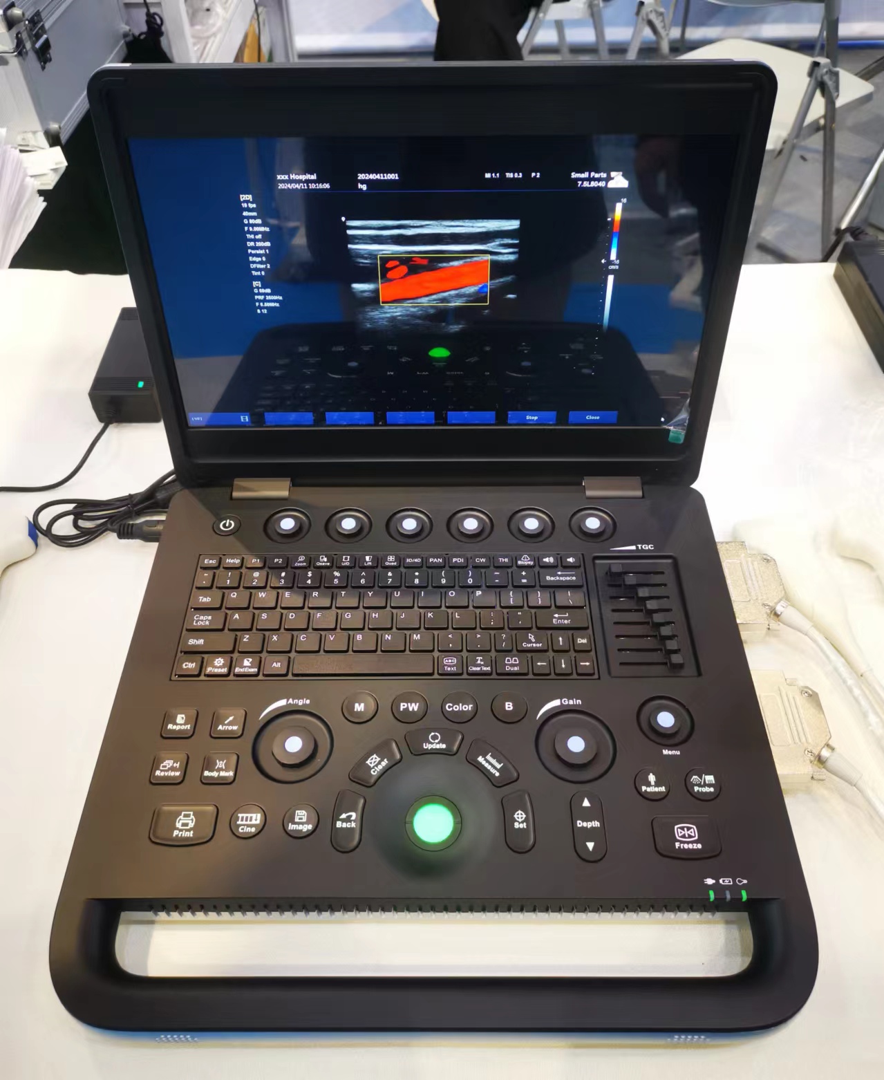 Notebook Color Doppler Asequible con bater&iacute;a y funci&oacute;n 3D dise&ntilde;o delgado-0