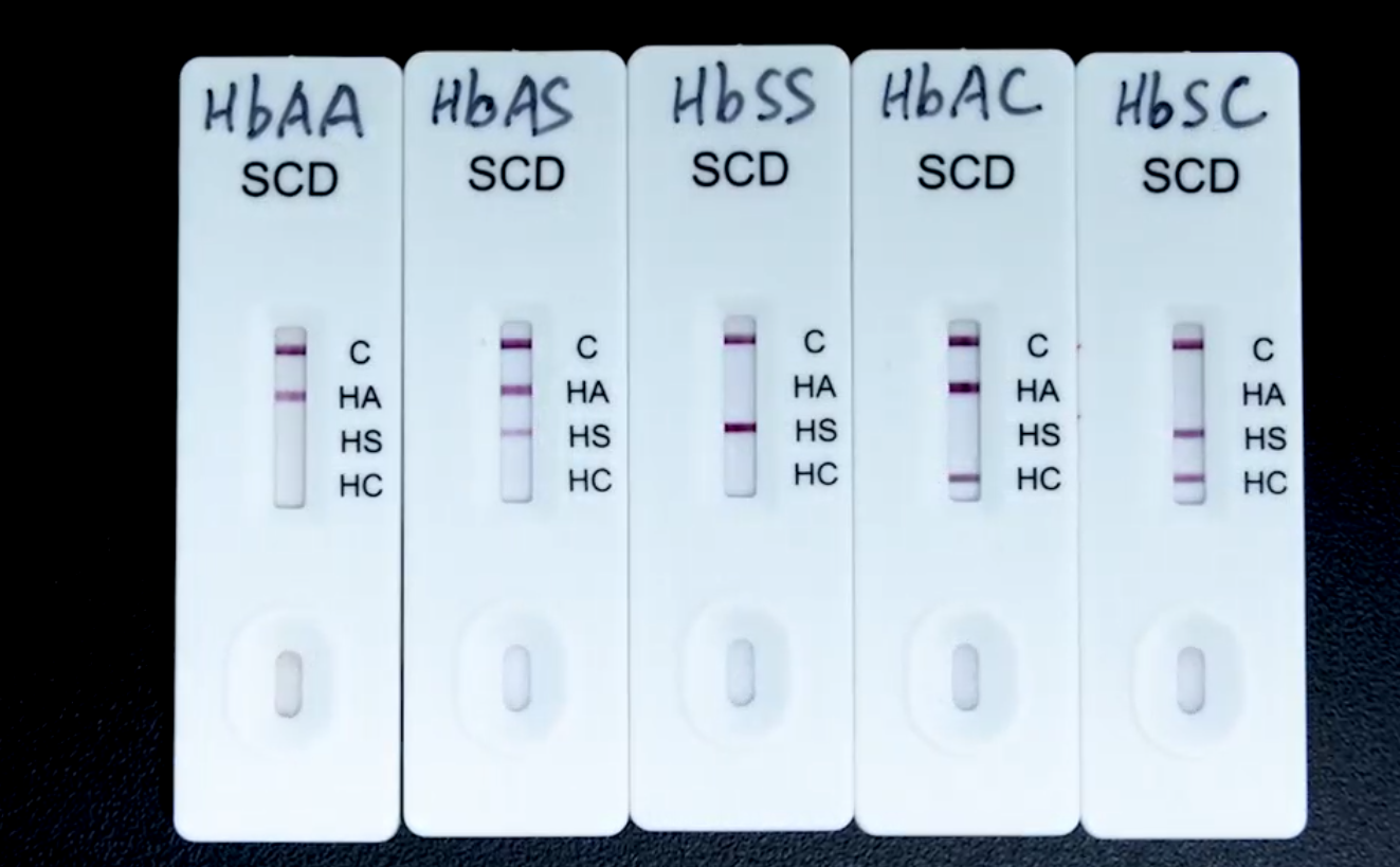 Ebola Virus Antigen Rapid Test-1