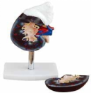 Life-Size Kidney Anatomical Model with Adrenal Gland-0