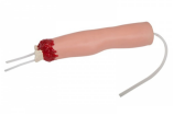 Modelo de hemostasia para amputaci&oacute;n traum&aacute;tica del miembro superior-0