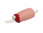 Modelo de hemostasia para amputaci&oacute;n traum&aacute;tica de extremidades inferiores-0