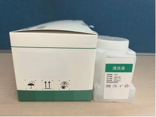 Serum Protein Electrophoresis 720 tests-1