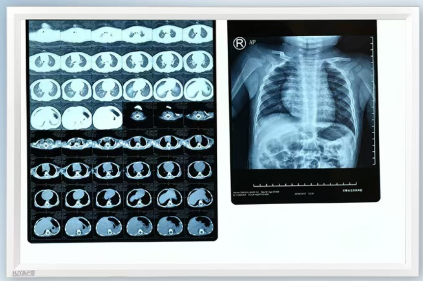 LED X-ray Film Viewer &ndash; Double-Panel