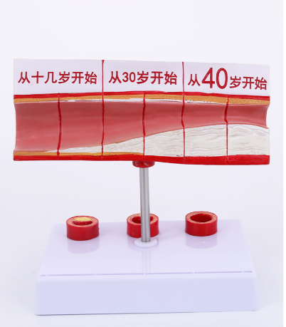 Large blood vessel model-0