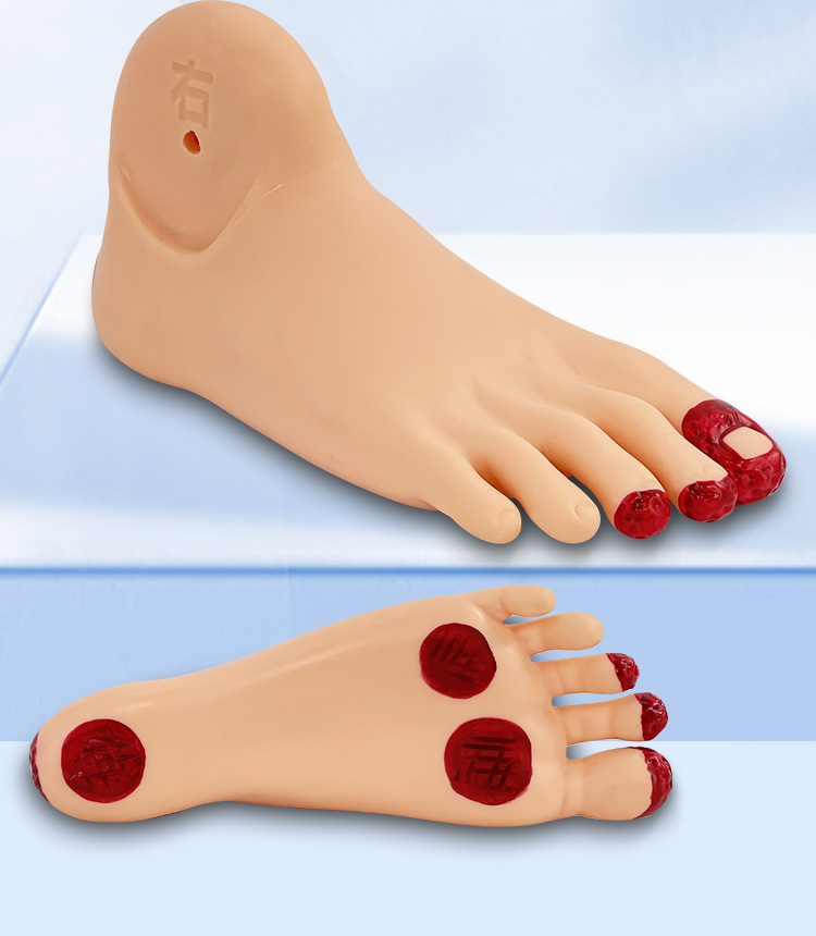 Diabetic foot care model-0