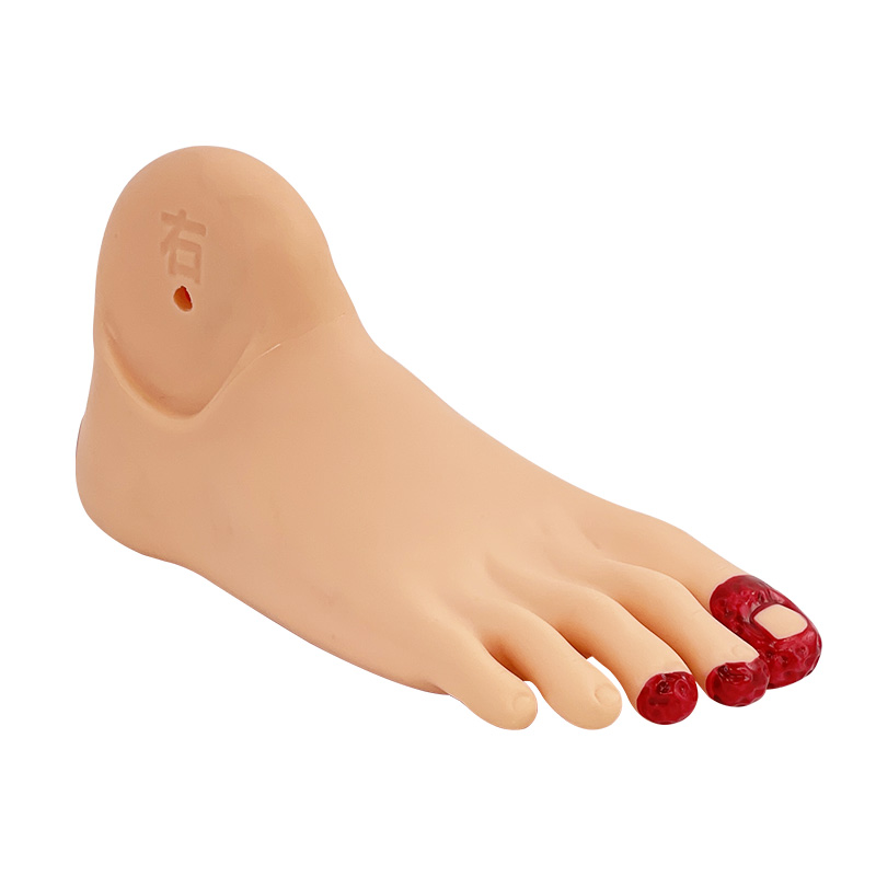 Diabetic foot care model-1