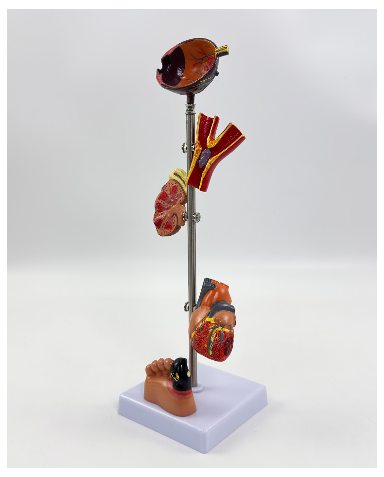 Diabetes model-0