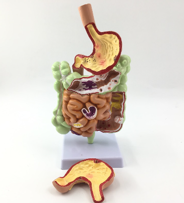 Pathological large intestine with stomach model-0