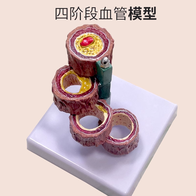 Four-segment vascular model-1