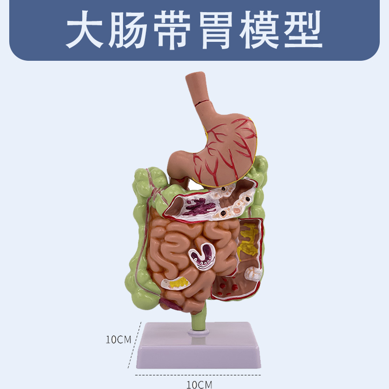 Pathological large intestine with stomach model-1