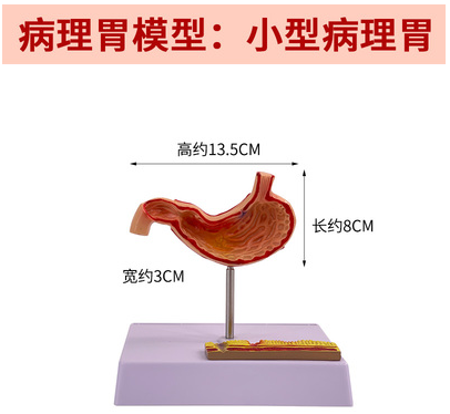 Pathological stomach (small size)-1