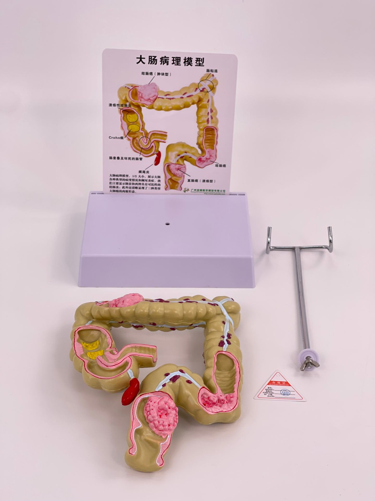 Large intestine pathological model (large size)-0