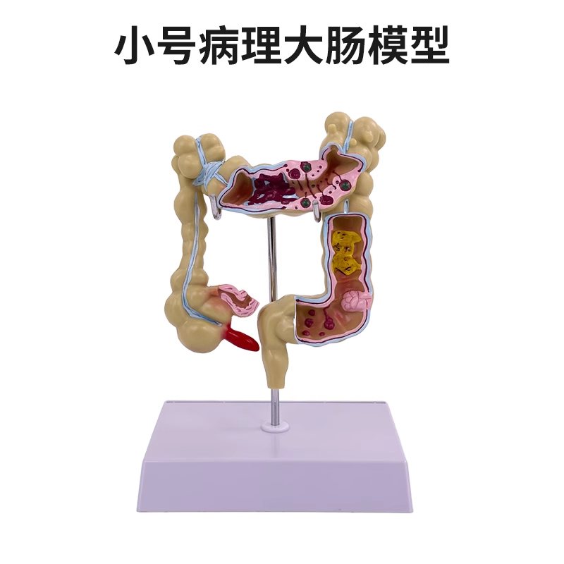 Colon pathological model (small size)-0