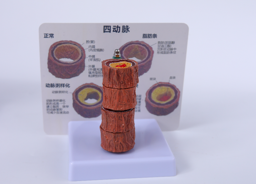 Four-segment vascular model-0