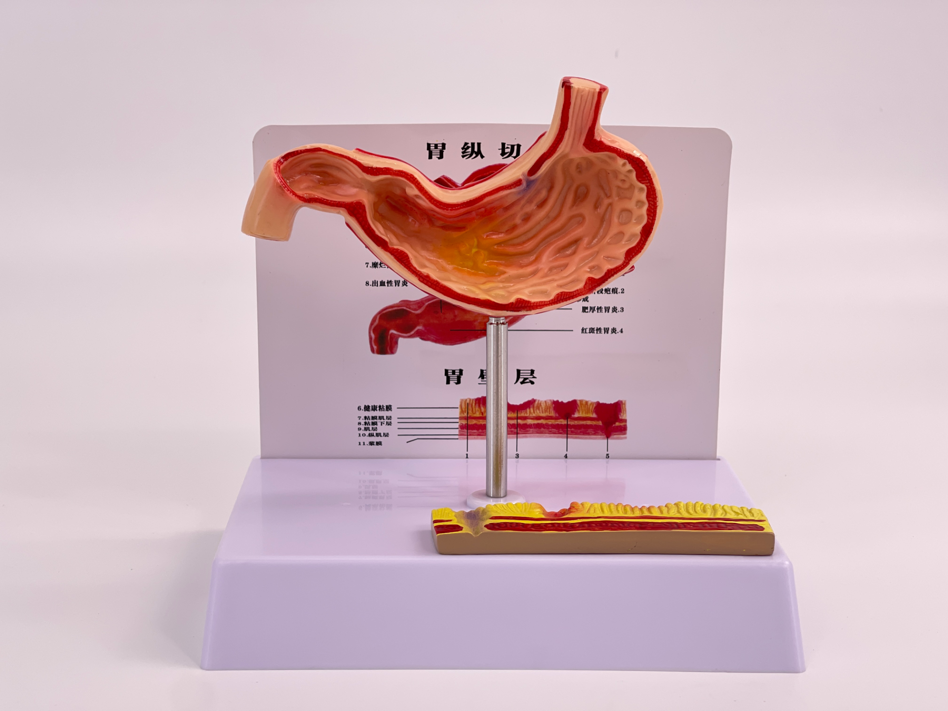 Pathological stomach (small size)-0