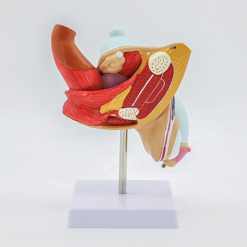 Male pathological genital structure-0