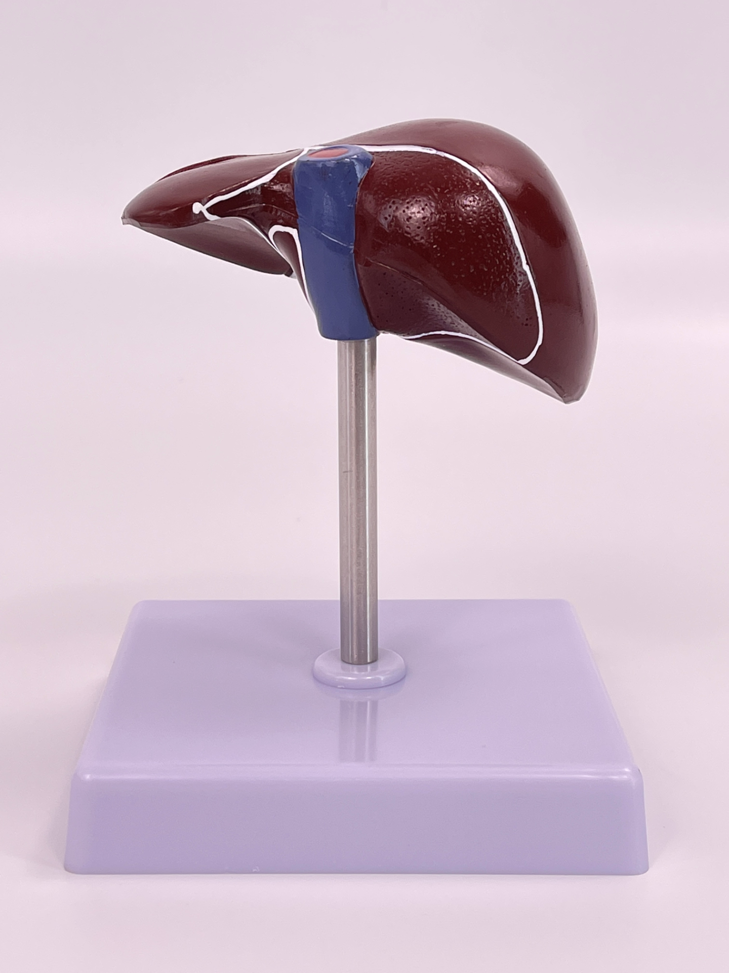 Pathological liver model-1