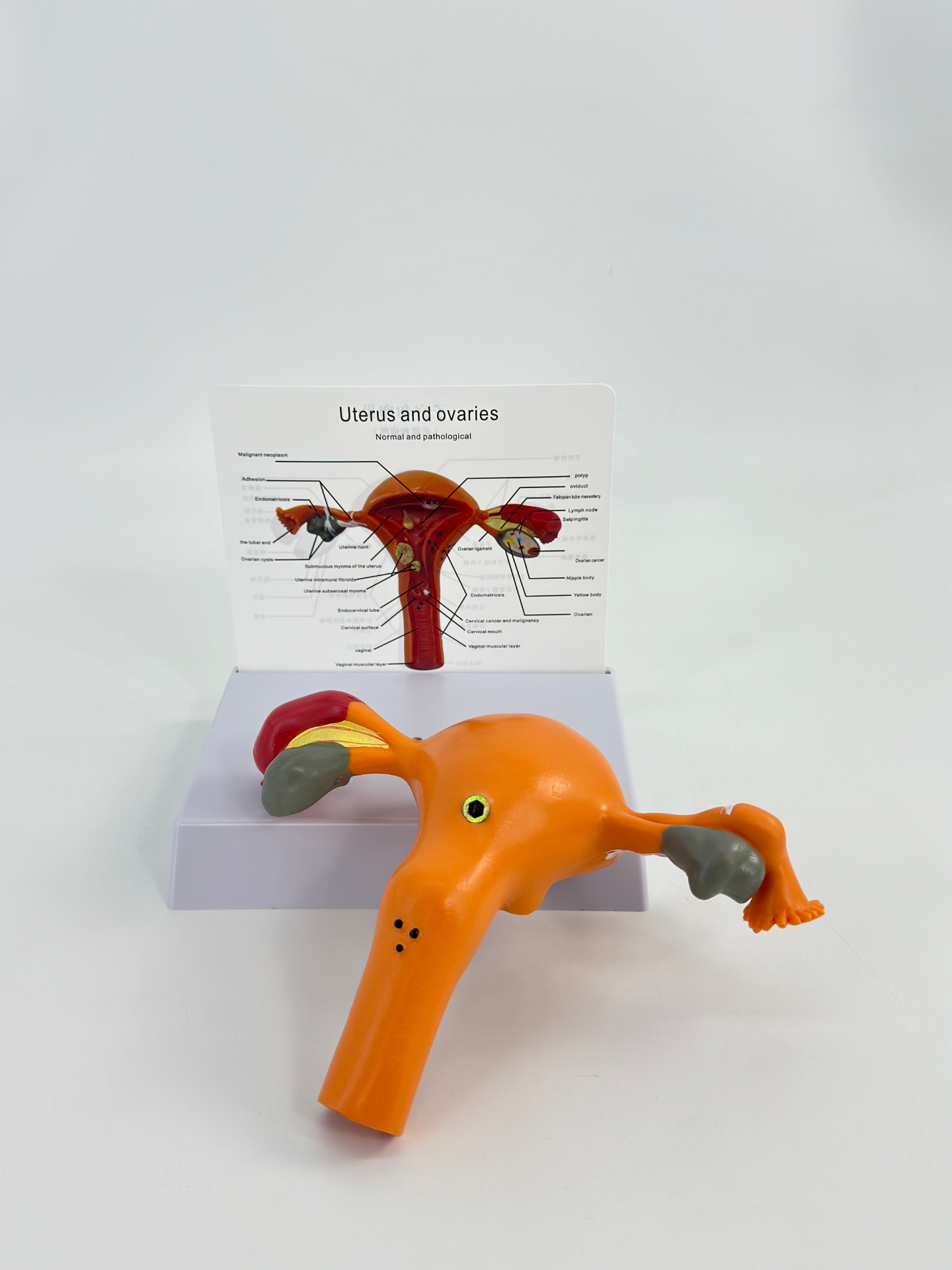 Pathological uterine model-1