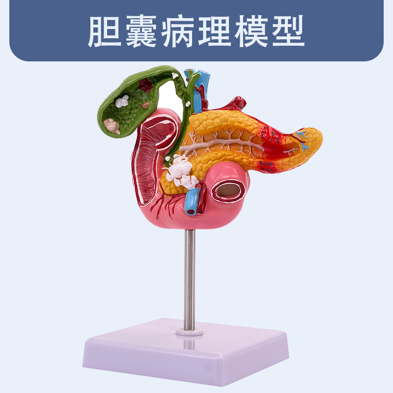 Gallbladder pathological model-1