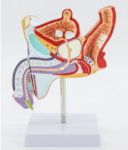 Male pathological genital structure-1