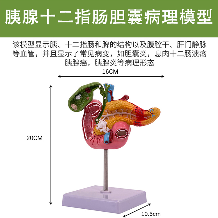 Gallbladder pathological model-0