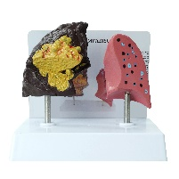 Lung contrast model-1